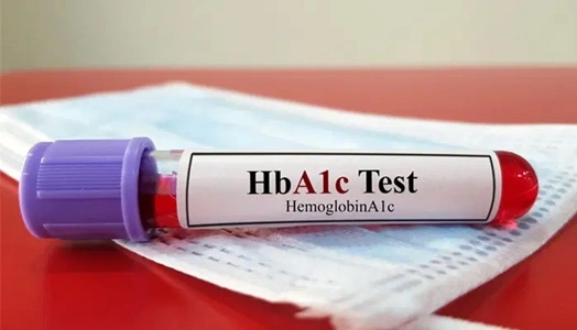  HbA1c 